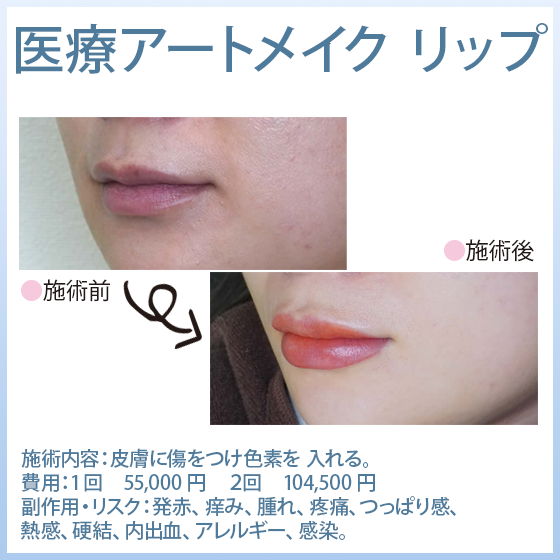 医療アートメイク リップ
